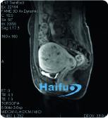 Antes del tratamiento