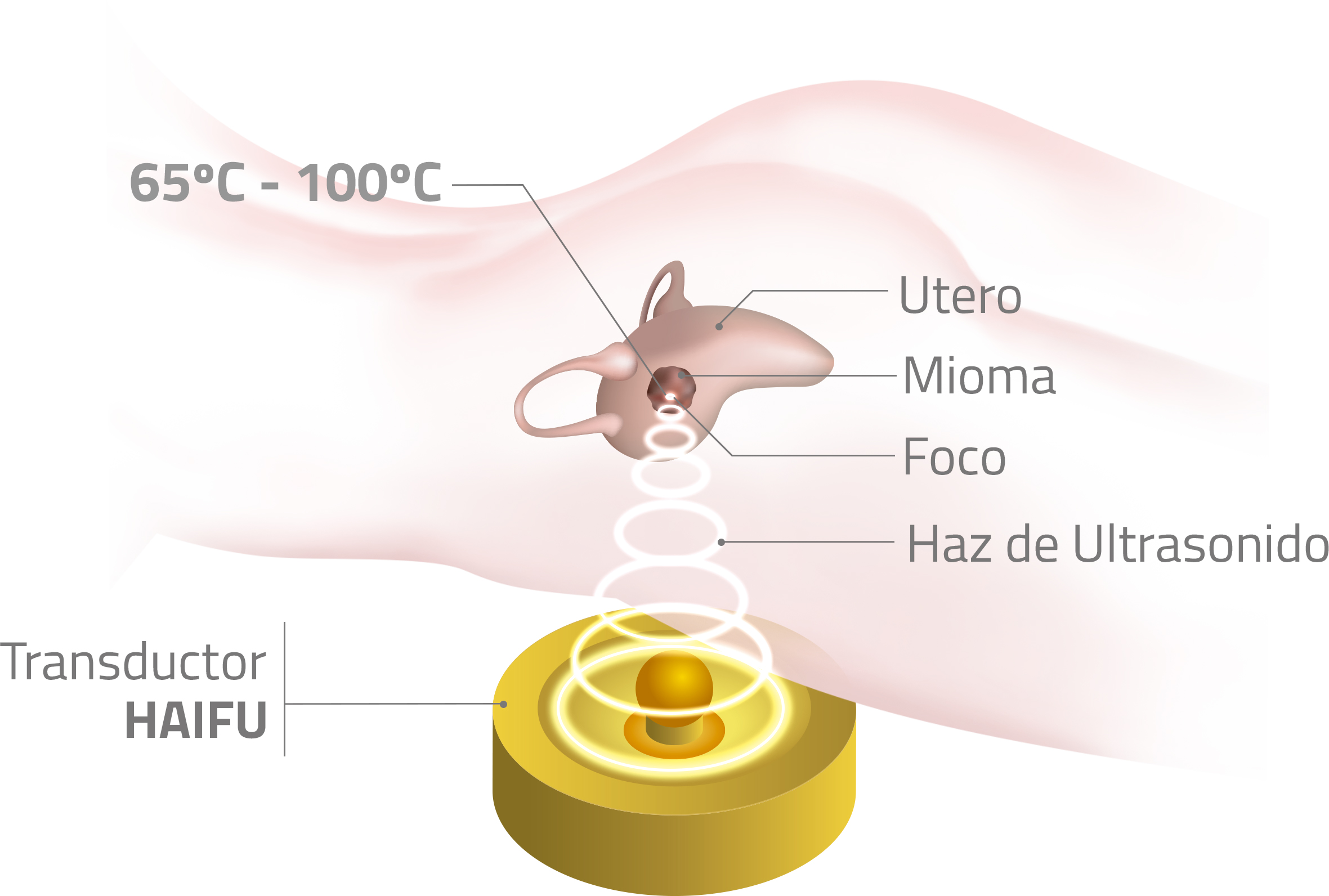 Transductor